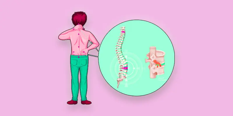 Scoliosis Causes, Symptoms, Types and Treatment 2 diagnosis scoliosis