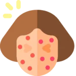 Systemic Lupus Erythematosus (SLE) treatment