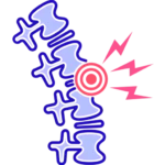 ankylosing spondylitis treatment