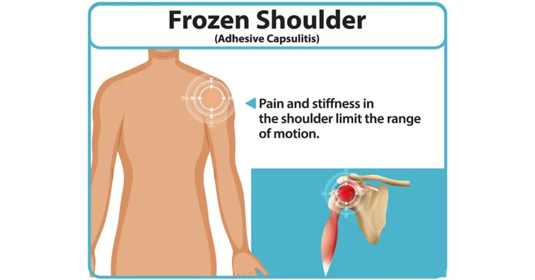 shoulder pain treatment